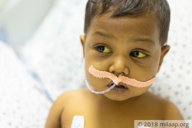 After Liver Disease Snatched Away One Child, This Father Is Milaap